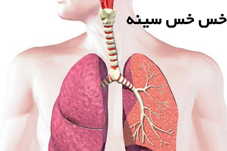 خس خس سینه چیست؟