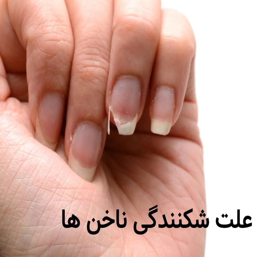 چرا ناخن ها می شکنند ؟