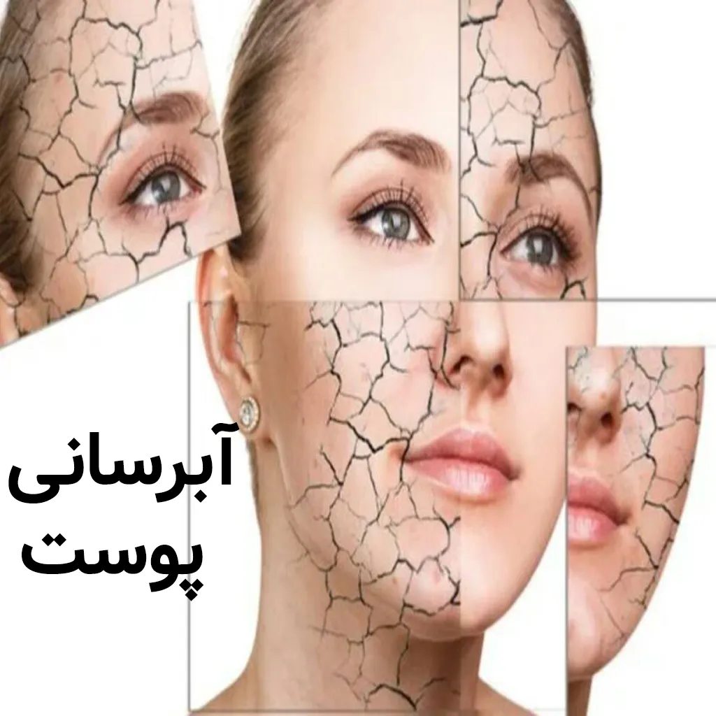 آبرسانی انواع پوست به روش خانگی