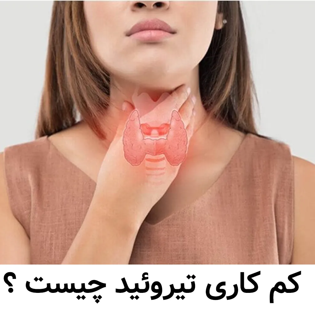 کم کاری تیروئید