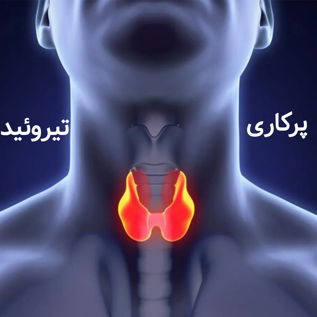 تیروئید پر کار چیست 
