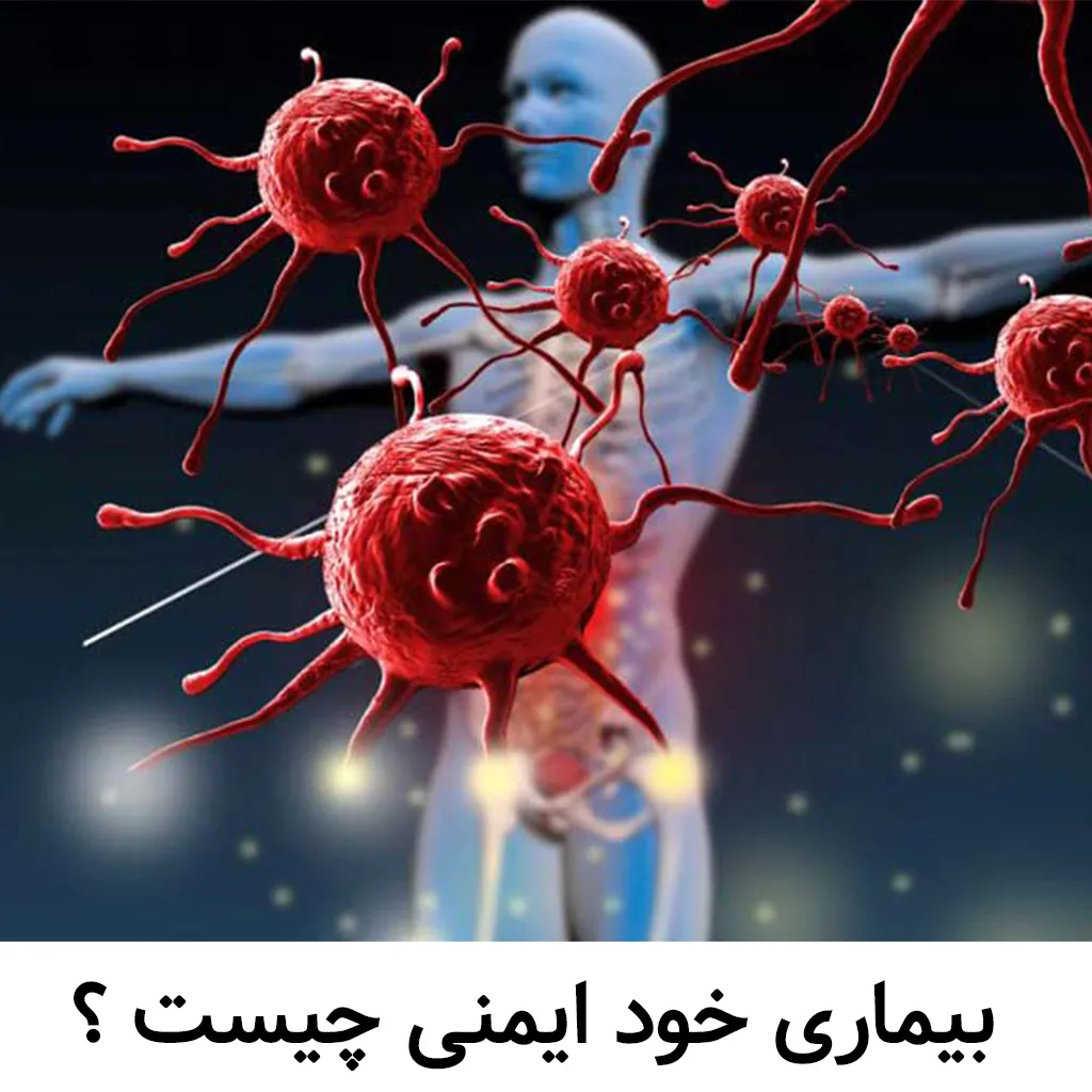 بیماری خود ایمنی چیست؟